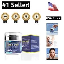 Luxury Dark Spot Corrector Cream - Natural Age & Sun Spot Remover for All Skin