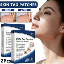 432PC Skin Tag Remover Patches Quick Effective Mole Wart Removal Pad Sticker New