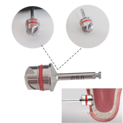 Dental Lateral Approach Lift Creat Window Im plant Reamer Dome Drill  Ø8.0