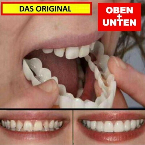 Snap On Veneers Kosmetische Zahnblende Comfort Prothese Falsche Zähne Flex Fit - Bild 1 von 7