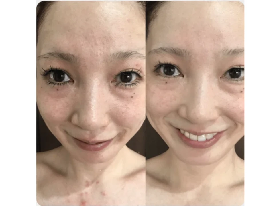 Majestic Skin - 20% Human Stem Cells Regenerative Serum from Japan 5ml - Image 4 of 4