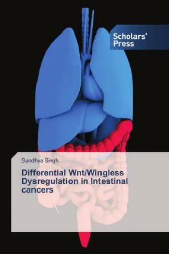 Thumbnail - Differential Wnt/wingless Dysregulation In Intestinal Cancers 2819