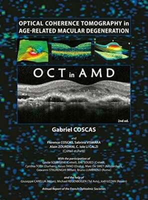 Optical Coherence Tomography in Age-Related Macular Degeneration: Buch Springer