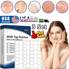 3Set Skin Tag Remover Patches Quick Effective Mole Wart Removal Pad Sticker Hot
