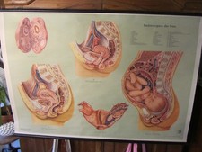 Lehrkarte Schulwandkarte Medizin "Die Beckenorgane der Frau" vintage