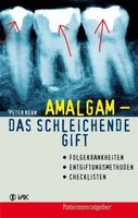 Amalgam - Das Schleichende Gift | Peter Kern | Deutsch | Taschenbuch | 168 S.
