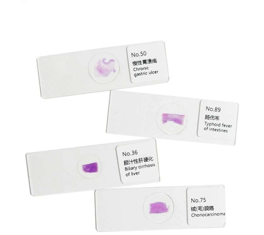 Diapositivas de muestra preparadas típicas de sección patológica de mamíferos 100 piezas Foto 2 de 4