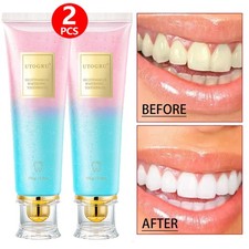 2X Nicotinamide Whitening Toothpaste Cleaning Brightening Whitening Fresh Breath