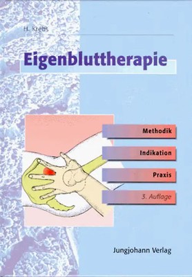 Eigenbluttherapie. Methodik, Indikation und Praxis