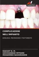 Complicazioni Nell'impianto Mohammed Nashiroddin