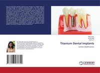 Delsa Raju (U. A.) | Titanium Dental Implants | Taschenbuch | Englisch (2021)