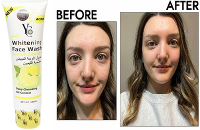 YC Whitening Face Wash With Lemon Extract for clean face Unisex  All Skin 100 ml