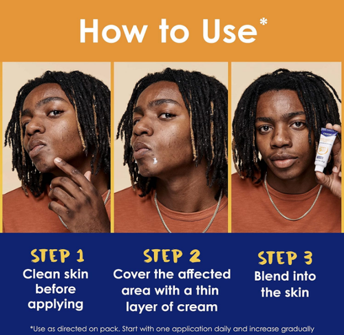 Crema Para Las Espinillas Quita Acne Puntos Negros Eliminar Barros Cara Cuello - Bild 4 von 8