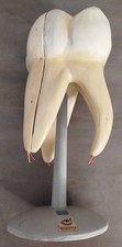 großes Lehrmodell  Zahn Zahnarzt Medizin Deutsches Hygiene Museum Dresden 