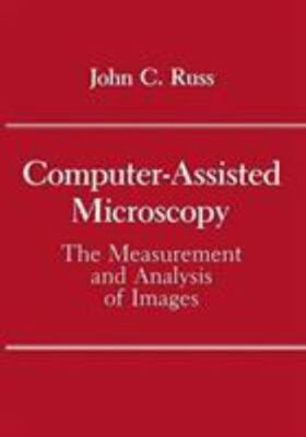 Computer-Assisted Microscopy: The Measurement and Analysis of Images
