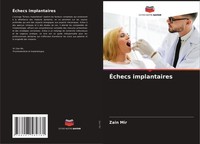 ÉChecs Implantaires Zain Mir