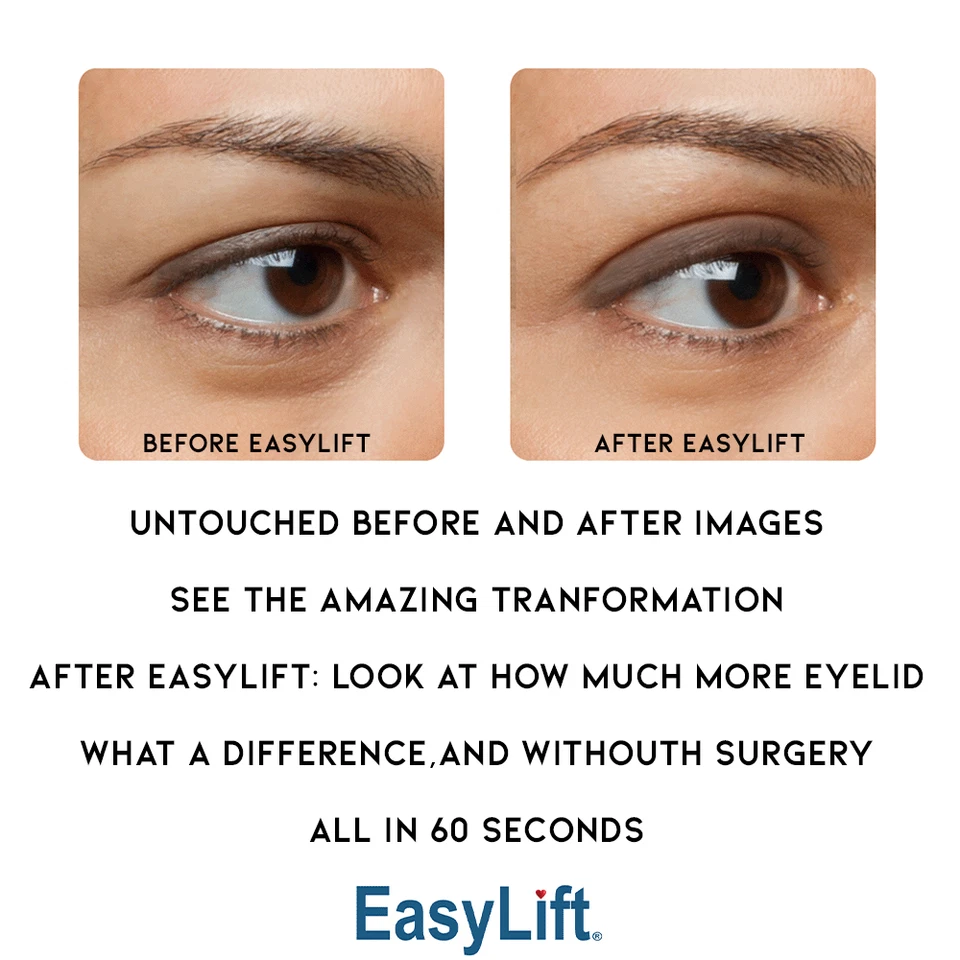 Lifting de ojos instantáneo Easy Lift Foto 3 de 4