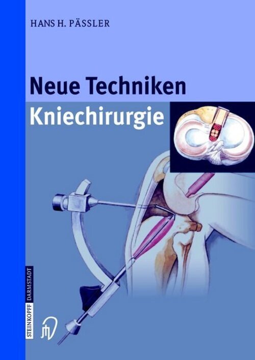 Neue Techniken Kniechirurgie | H. H. Pässler | Taschenbuch | X |