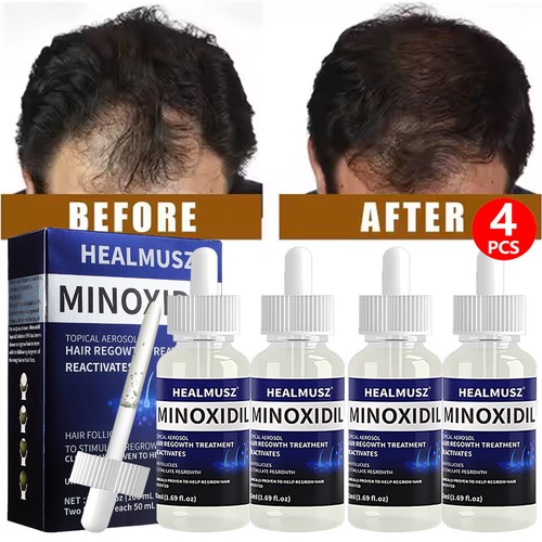 4xExtra Strength Hair Loss&Regrowth Scalp Serum Treatment for Men 4 Month Supply - Picture 3 of 21