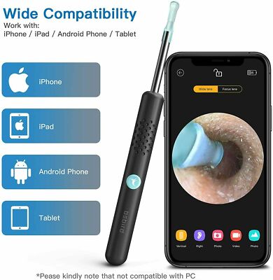 Bebird 1080P Ear Wax Removal Ear Camera Cleaning Endoscope Spoon Mini Ear Picker