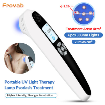 308nm Excimer UV Light Physiotherapy Device For Skin Diseases 6 Diodes 20mW/cm²