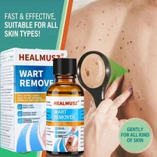 Wart Remover Liquid Skin Tag Mole Remover Eliminate Feet Corn Wart Removal 30ML