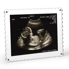 5x7 Ultrasound Picture Frame, Sonogram Picture Frame with Magnetic Back   Cle...