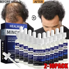 2-10Pack Minoxidil 5% Hair Regrowth Solution Extra Strength Men 10 Month Supply