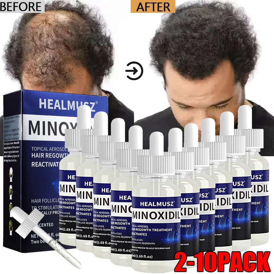 Minoxidil 5% Extra Strength Men 10 Month Supply Hair Regrowth Solution 10Bottles - Image 3 of 4