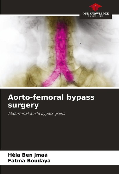Aorto-Femoral Bypass Surgery Abdominal Aorta Bypass Grafts HèLa Ben Jmaà (U. A.)-image