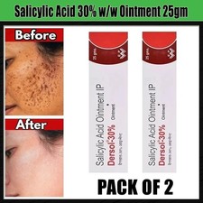 Salicylic Acid 30 w/w Ointment 25gm - 2 PACK