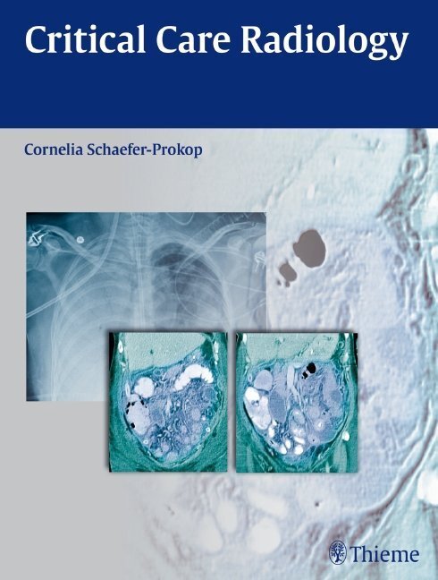 Thumbnail - Critical Care Radiology Von Cornelia M. Schaefer-prokop