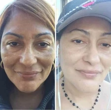 White Fade Super Skin Lightener Cream, Para Piel Triguena o Morena 1.7oz.