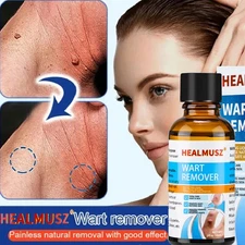 New Wart Remover Liquid Skin Tag Mole Remover Eliminate Feet Corn Wart Removal