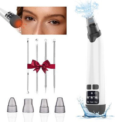 Blackhead Remover Vacuum with 3 Adjustable Suction Levels,4 Probes,USB Interface