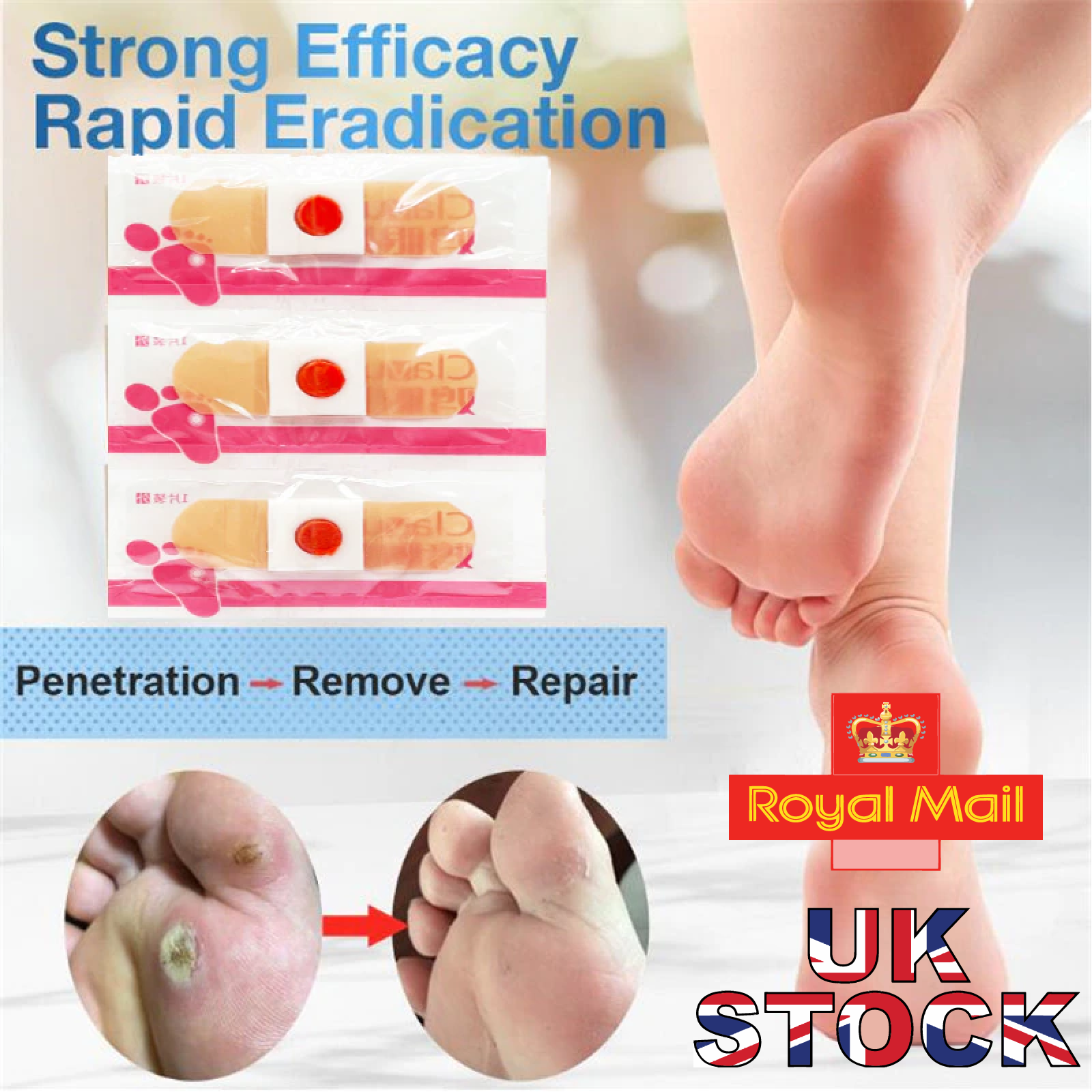 Wart Removal  Foot Corns Treatment in Bangalore