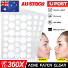Skin Tag Remover Acne Pimple Patch Removal Facial Care Spot Plaster AU STOCK