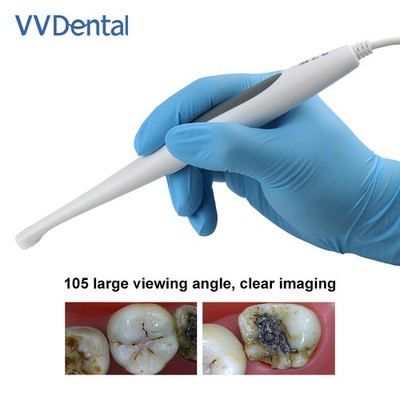 Dental Wired Dental Intraoral Camera 1080P HD Oral Detector Digital Viewer