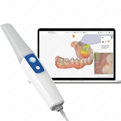 Dental 3D Intraoral Scanner with 10um Accuracy 2-Year Warranty