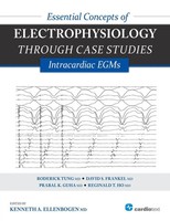 Kenneth A Ellenbogen (U. A.) | Essential Concepts Of Electrophysiology...