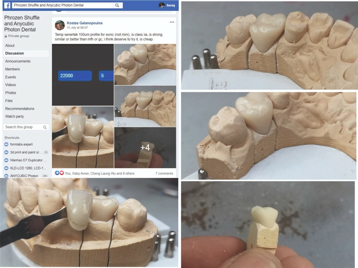 TrueDent™ Application: 3D Printing Full Digital Dentures