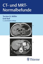 CT und MRT Normalbefunde ~ Torsten Bert Möll...
