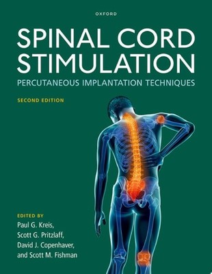 Spinal Cord Stimulation: Percutaneous Implantation Techniques -