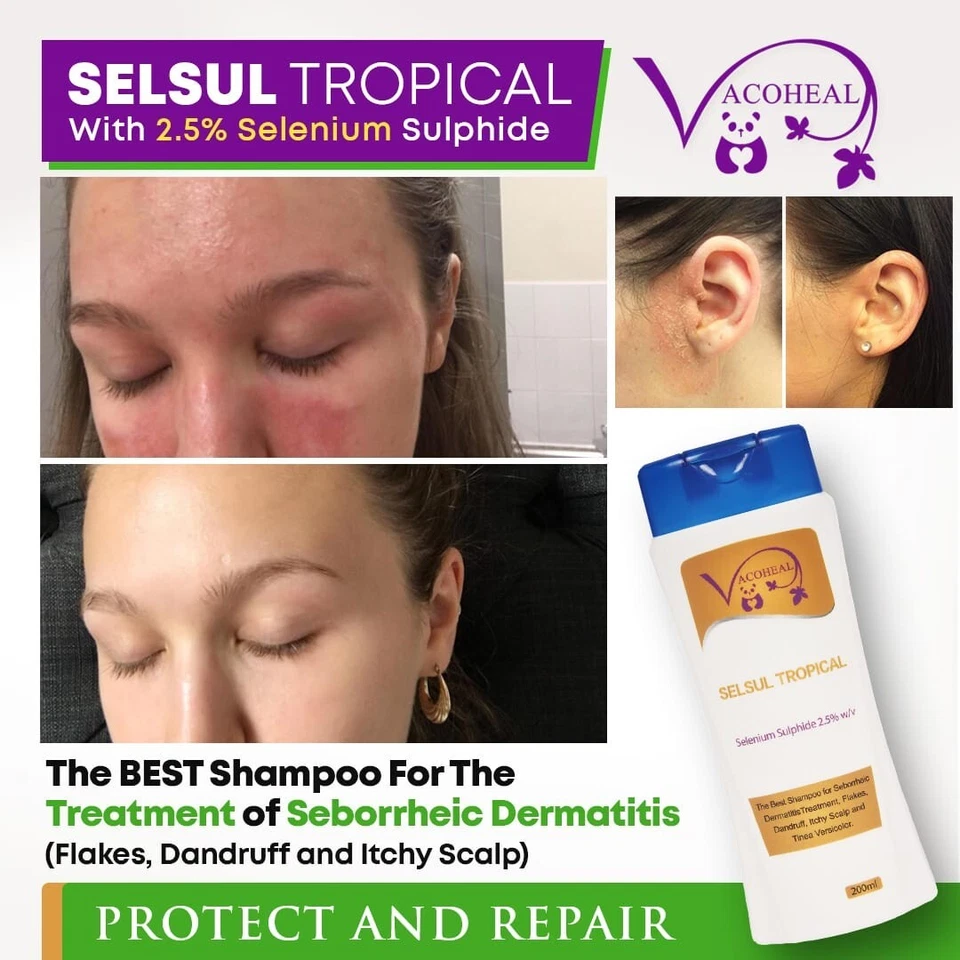 2.5% Selenium Sulphide Seborrheic Dermatitis Dandruff Shampoo Selsul Tropical UK - Image 4 of 4