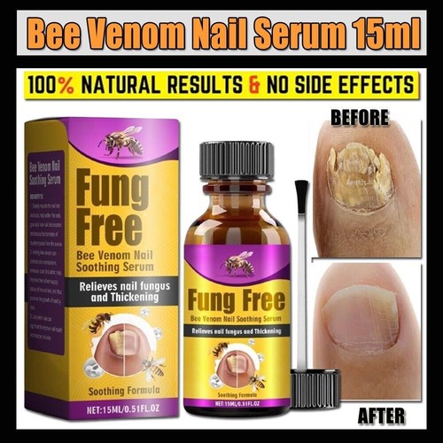 Fungus 2 Man Products – The Originals Nail & Foot Fungus Support – Antifungal Solution – USA Made