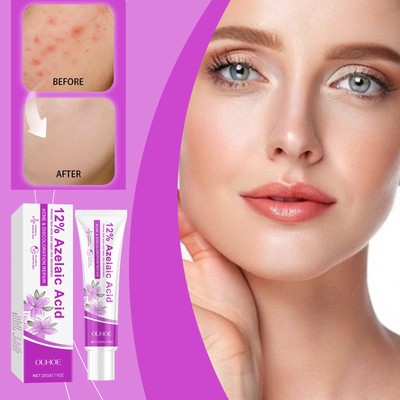 Salicylinsäure -Reinigungscreme Azelainsäure -Gel Akne -Creme Entfernen Sie Sc