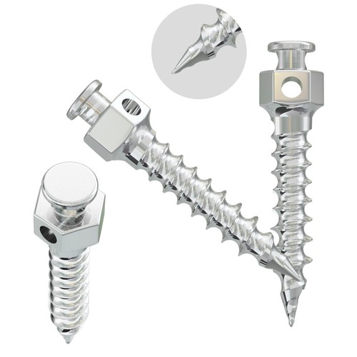 J&J Ortho™ Orthodontic Smart Anchor Mini Screw Implant eBay