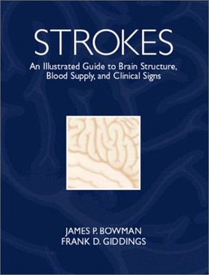 Strokes : An Illustrated Guide to Brain Structure, Blood Supply,
