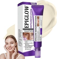 Pigmentation Removal Cream Anti Wrinkle Anti Aging Dark Spot Remover Retinol