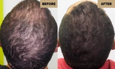 Minimalist Hair Regrowth Solution Extra Strength 30ml + Free Shipping